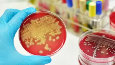Global diphtheria surge hits record levels as Nigeria, Australia, and the Americas report significant outbreaks