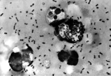Suspected Plague Death in Siberia Triggers Regional Health Lockdown