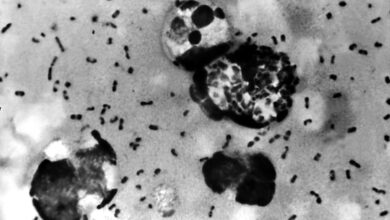 Suspected Plague Death in Siberia Triggers Regional Health Lockdown